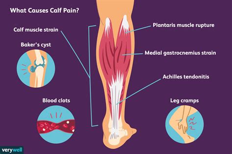 The <b>calf</b> muscles area unit in your lower leg behind your tibia and extend from the. . Calf feel teary all hunch gibberish